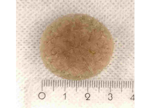 Ritos Žilinskienės veterinarijos klinikoje echoskopo pagalba diagnozuotas ir sėkmingai pašalintas beveik 30mm urolitas (šlapimo pūslės akmuo).